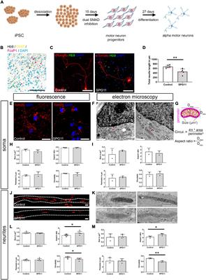 Axon-Specific Mitochondrial Pathology in SPG11 Alpha Motor Neurons